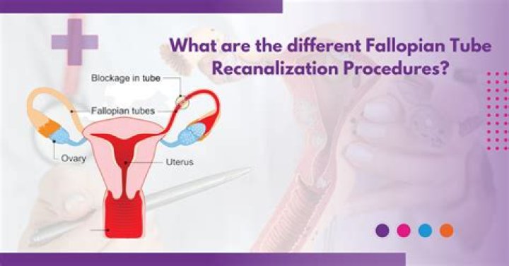 Are fallopian tubes attached to uterus