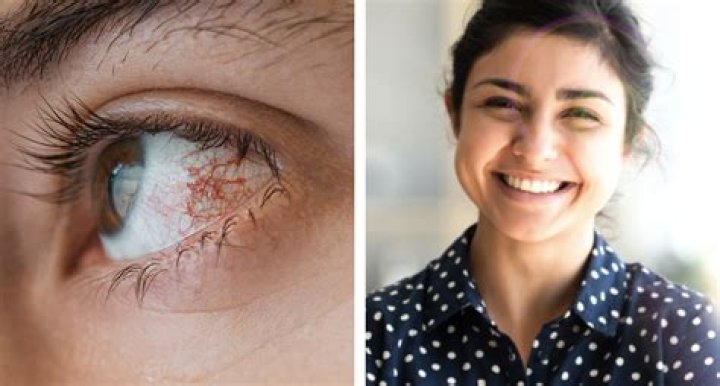 Can chilli damage your eyes