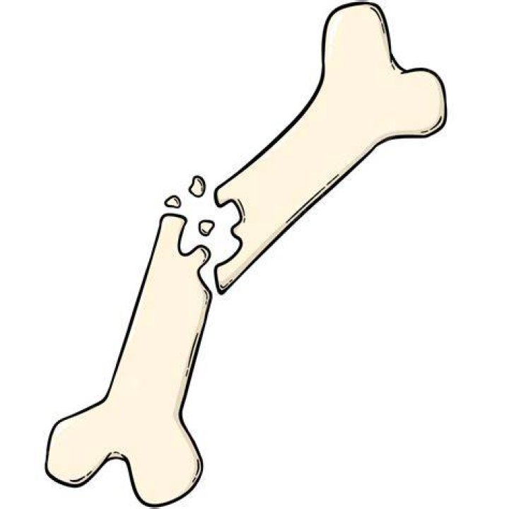 Can you get sick from a broken bone