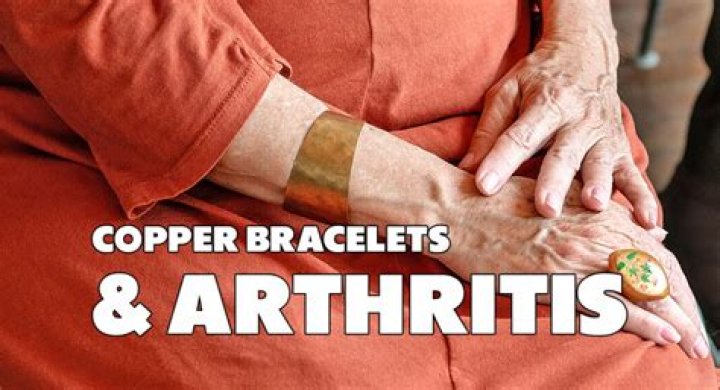 Do copper bracelets help with arthritis