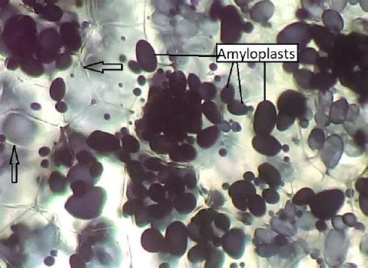 Do potato cells have amyloplasts?