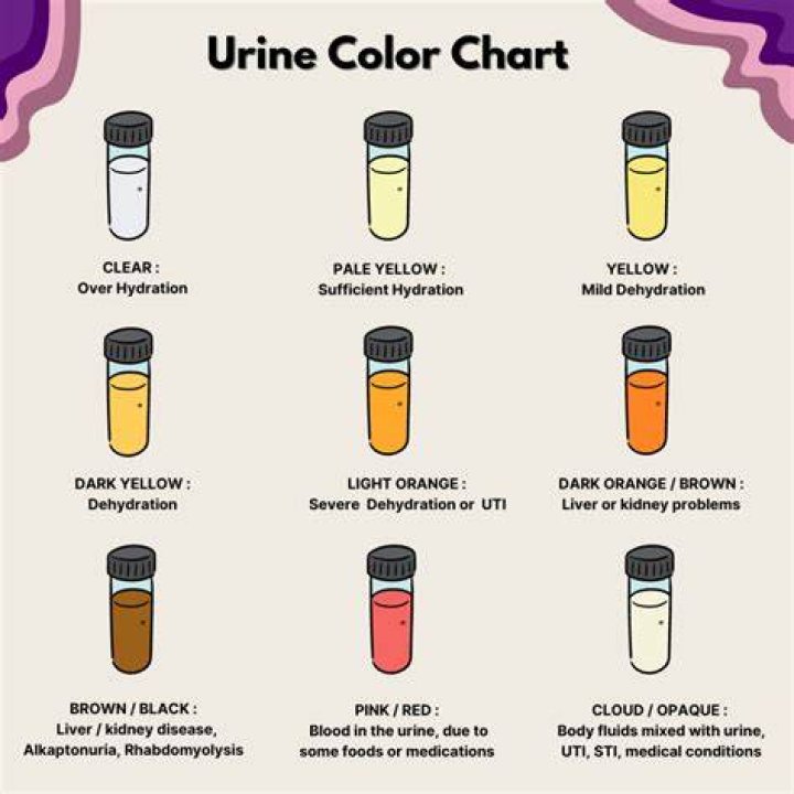 Does clindamycin change urine color
