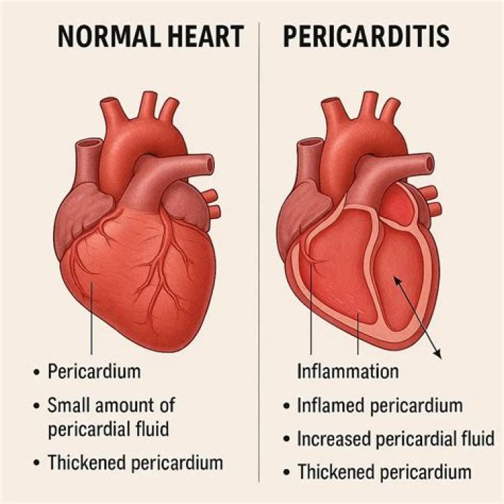 Does pericardium make fluid reduce friction
