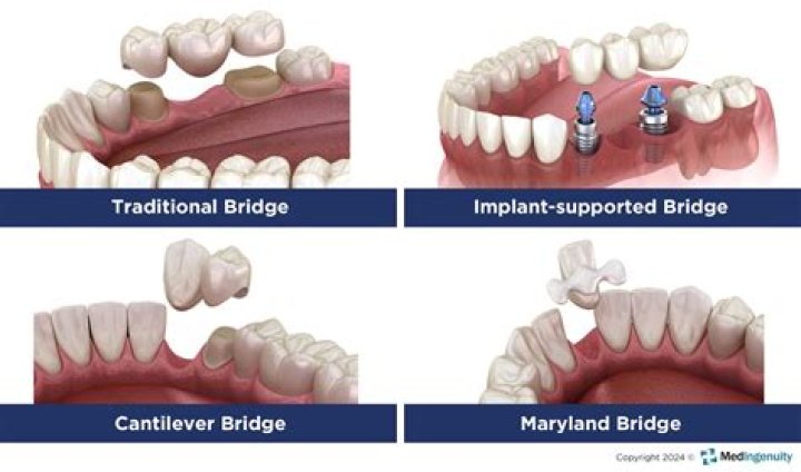 How can I get dental financing