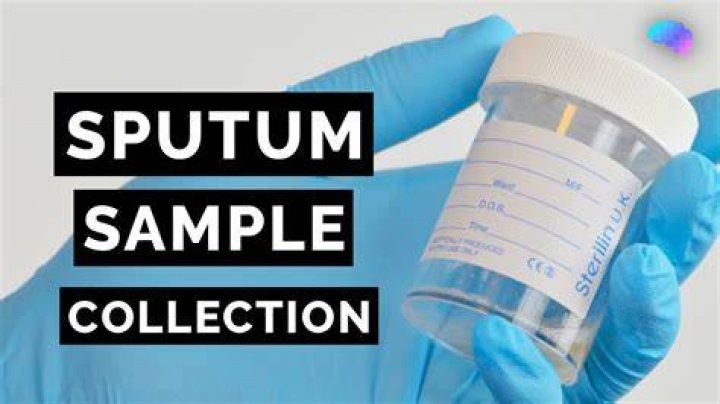 How do you collect a sputum sample