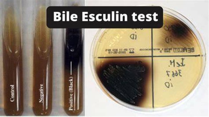 How is bile Esculin differential