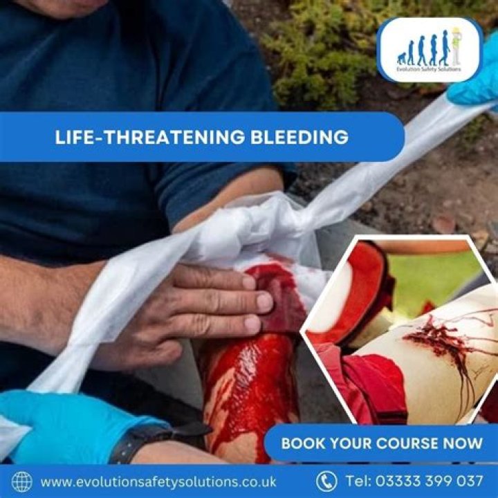 Is CVID life threatening
