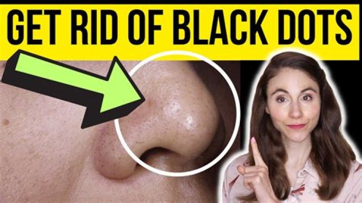 What are black spots inside potatoes?