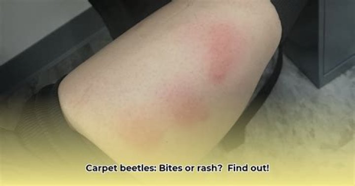 What do carpet beetle bites look like