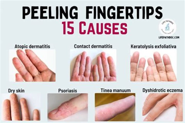What does peeling a potato do?