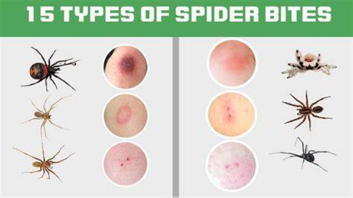 What does salt do to spiders