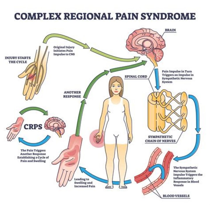 What is CRPS designation