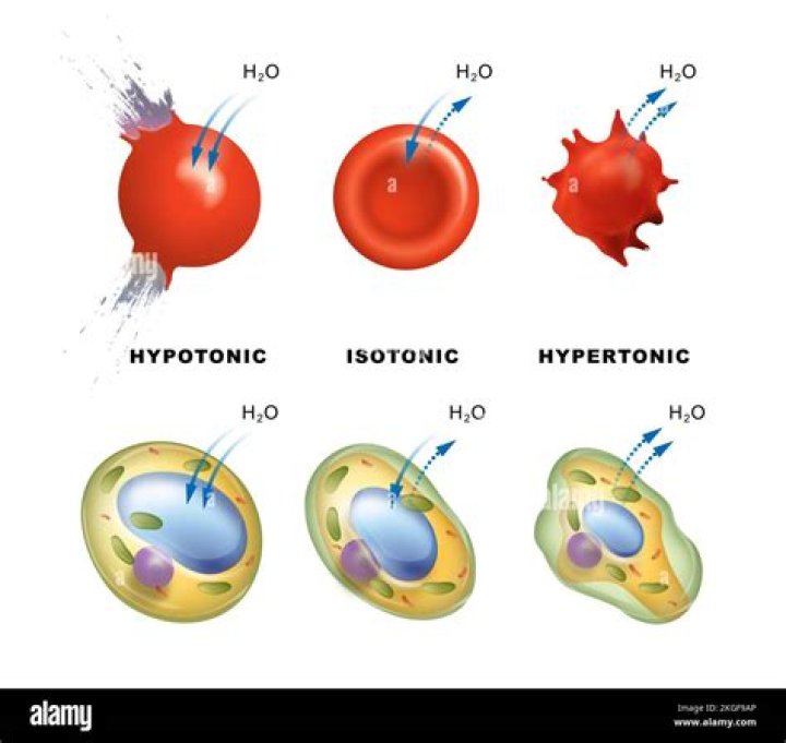 What is Hypertonicity