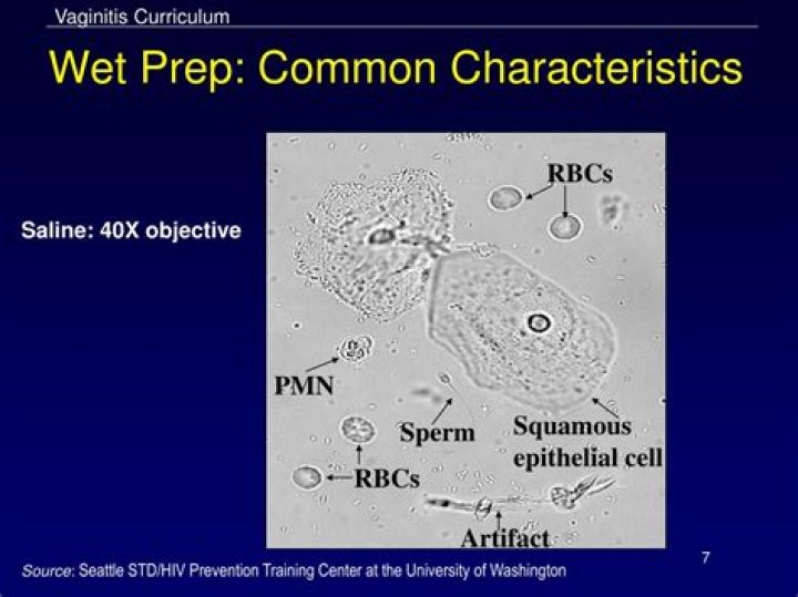 What is RBC wet prep