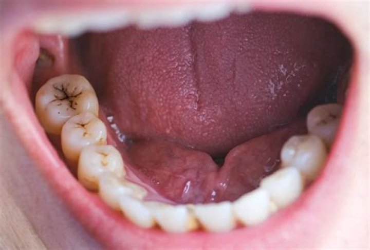 Where does the term al dente come from?