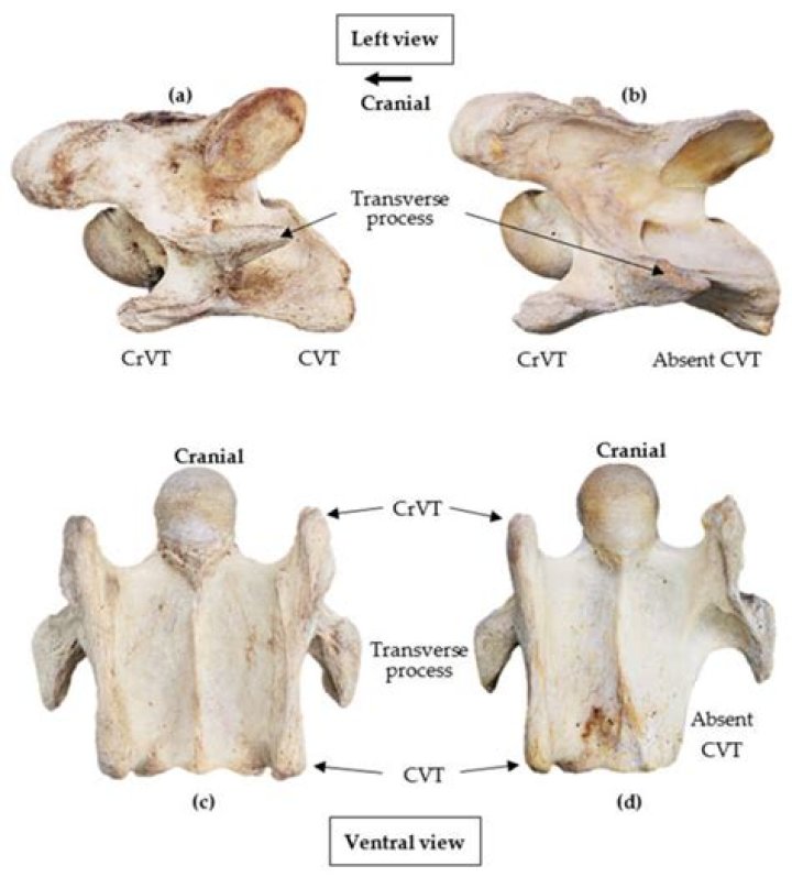 Where does the transverse cervical nerve originate